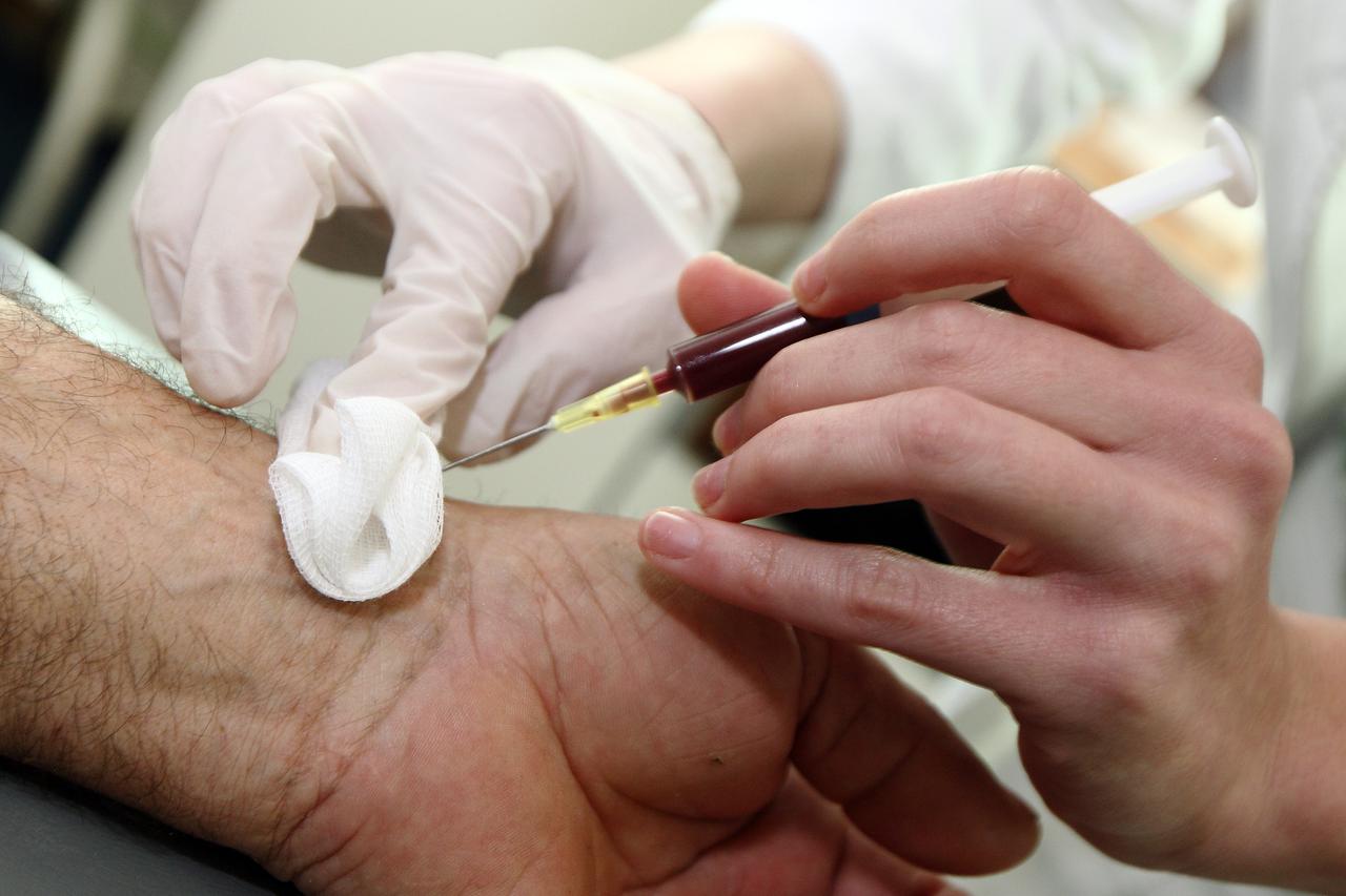 09.03.2012., Zagreb - Doc.dr. Sanja Grle Popovic iz Klinike za plucne bolesti Jordanovac pokazuje pretrage koje pacijent mora obaviti da bi se utvrdilo boluje li od alergije. Nalaz plinova u krvi dobija se vadjenjem krvi iz arterije, a gotov je u svega pa