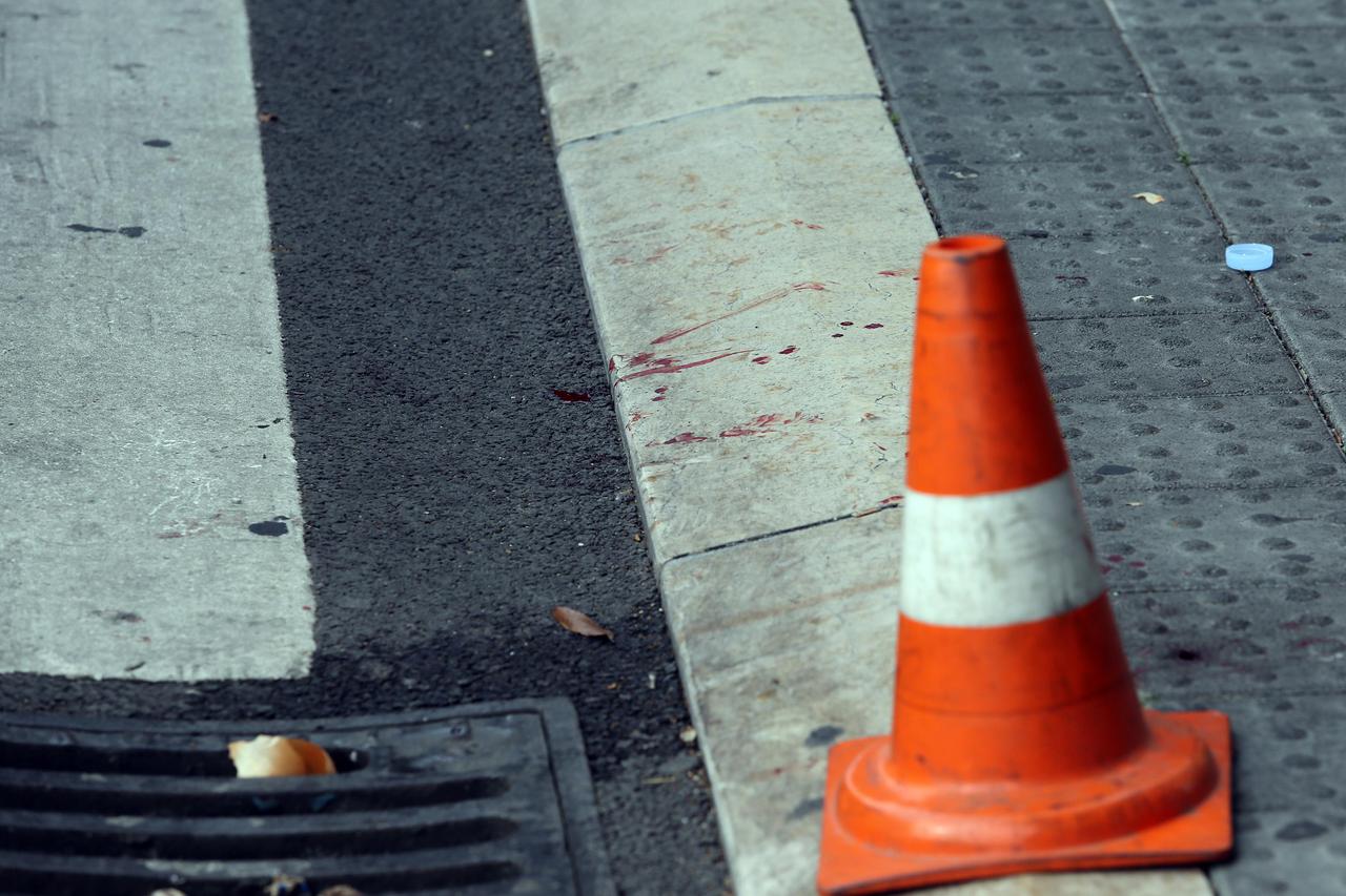 Rijeka: Osobnim automobilom na pješa?kom prijelazu udario pješakinju