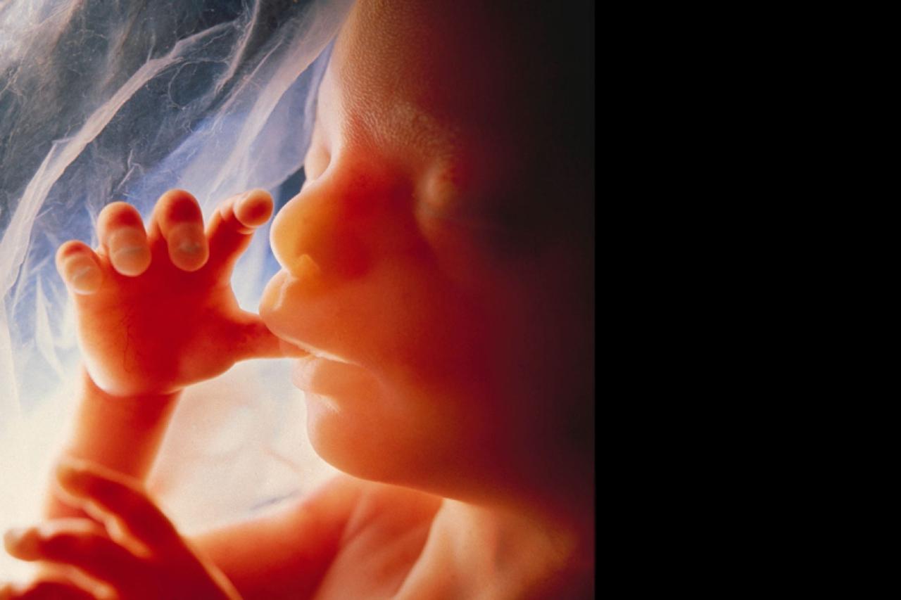fetus