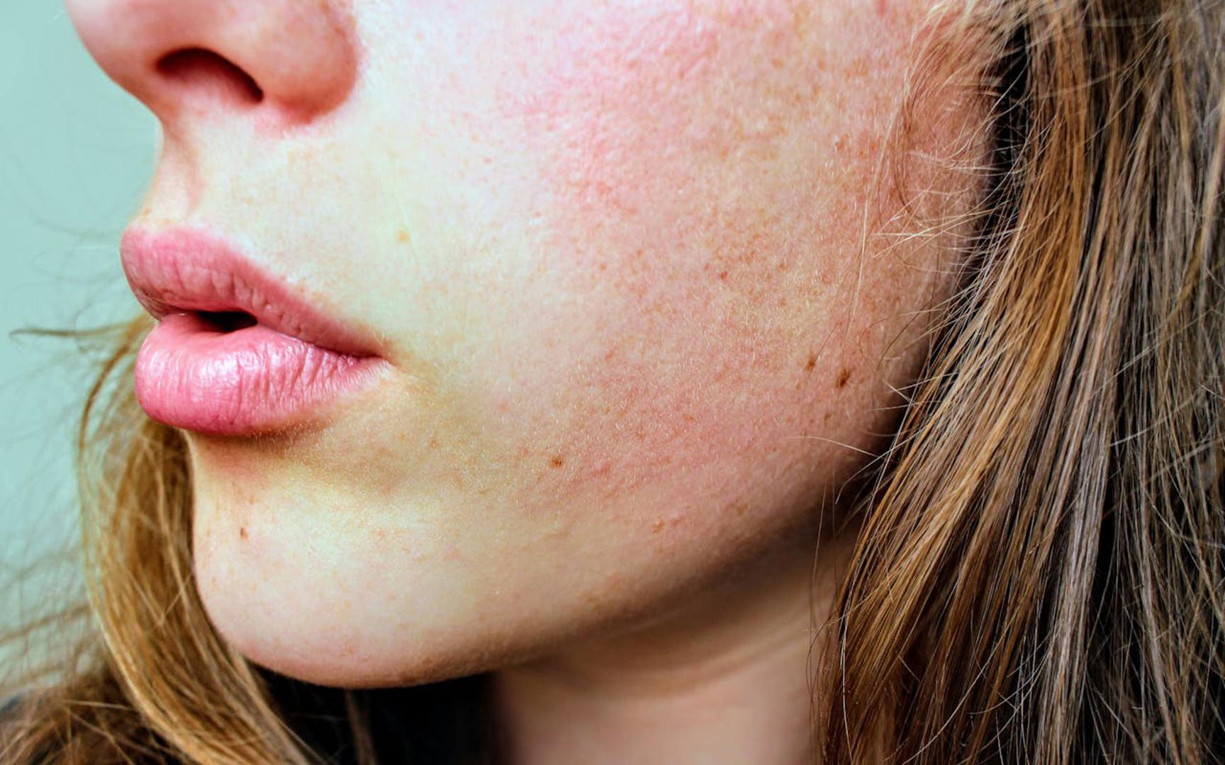 Suha usta, usne i 'ljepljiv' osjećaj u ustima: Suhoća usta ne dolazi samo od grijanja ili kave, često je klasičan znak dehidracije. Možete primijetiti i ispucale usne ili da vam se jezik 'lijepi' za nepce. Ako se ovo ponavlja, tijelo vam vrlo izravno poručuje da mu treba više tekućine. 