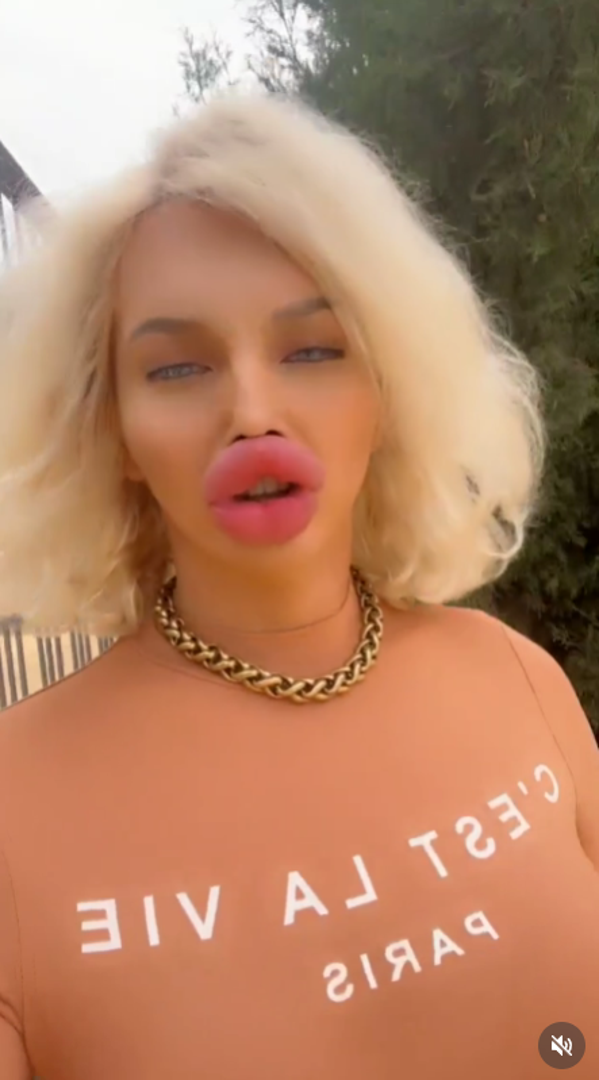 Influencerica je započela s kozmetičkim postupcima već s 18 godina, kada je prvi put stavila filere u usne, a danas njezino tijelo ima „više plastike nego tjelesne masti.”