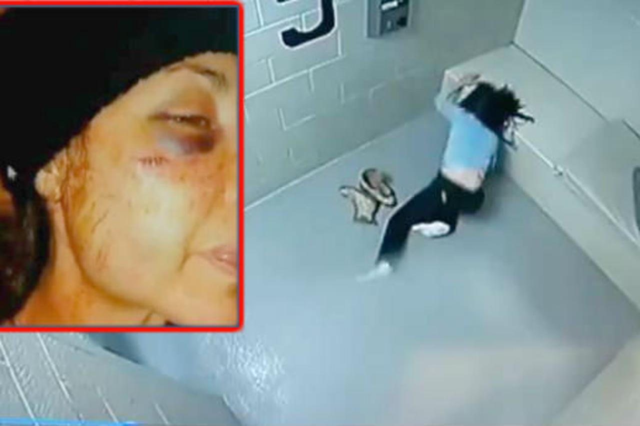 Cassandra je zbog težine ozljeda bila podvrgnuta plastičnoj operaciji