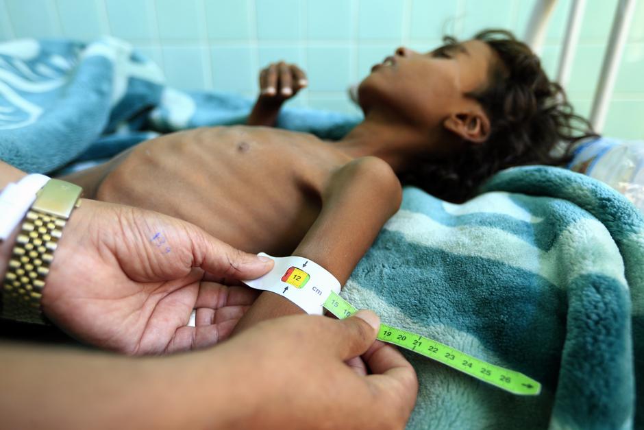 UNICEF