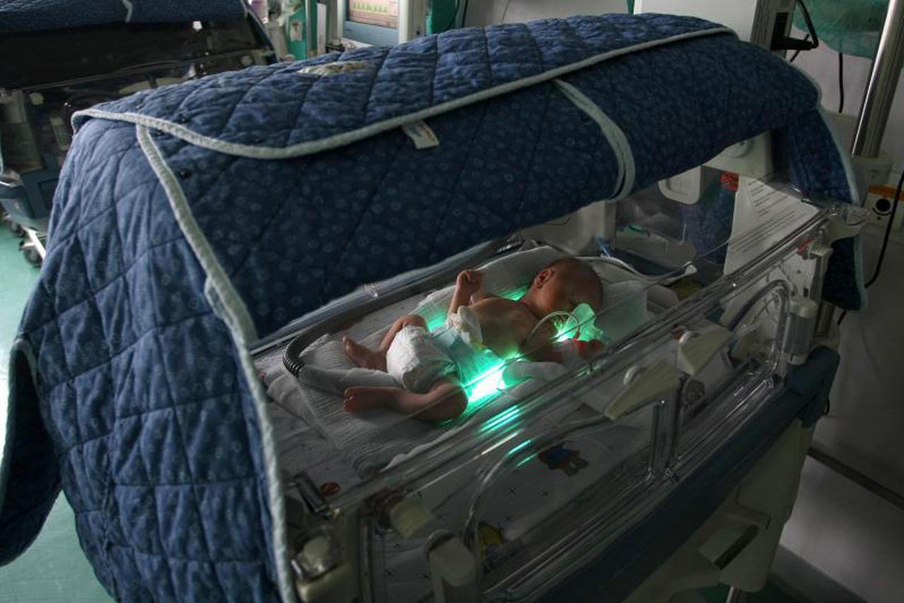 palcic gore,inkubator (1)