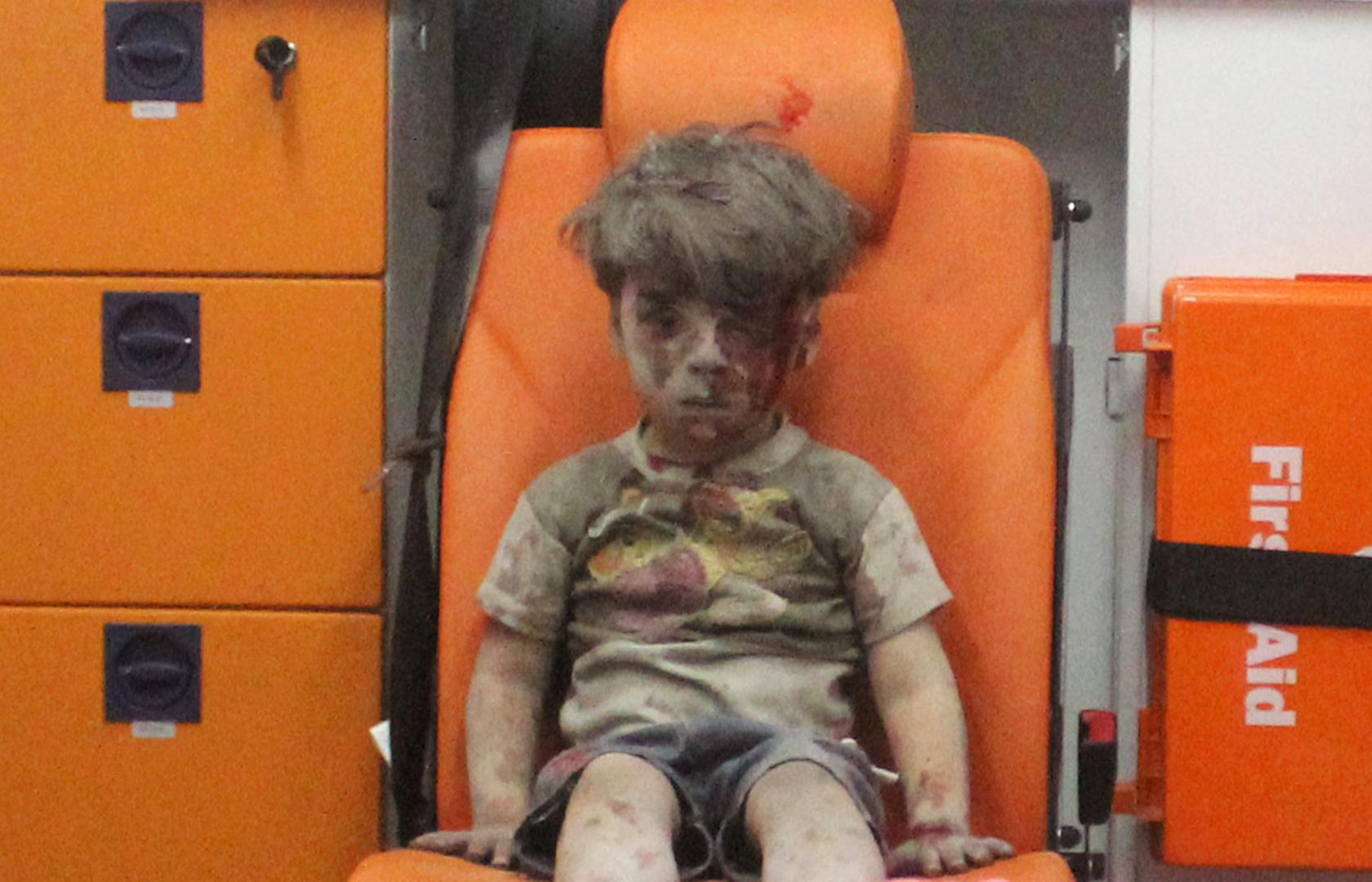 Omran Daqneesh dječak je koji je ranjen u ratu u Siriji 2016. godine kada je imao samo pet godina. Neki su ga proglasili i licem koje simbolizira sve užase rata između vladinih snaga i pobunjenika u koji su se kasnije uključile i velike svjetske sile