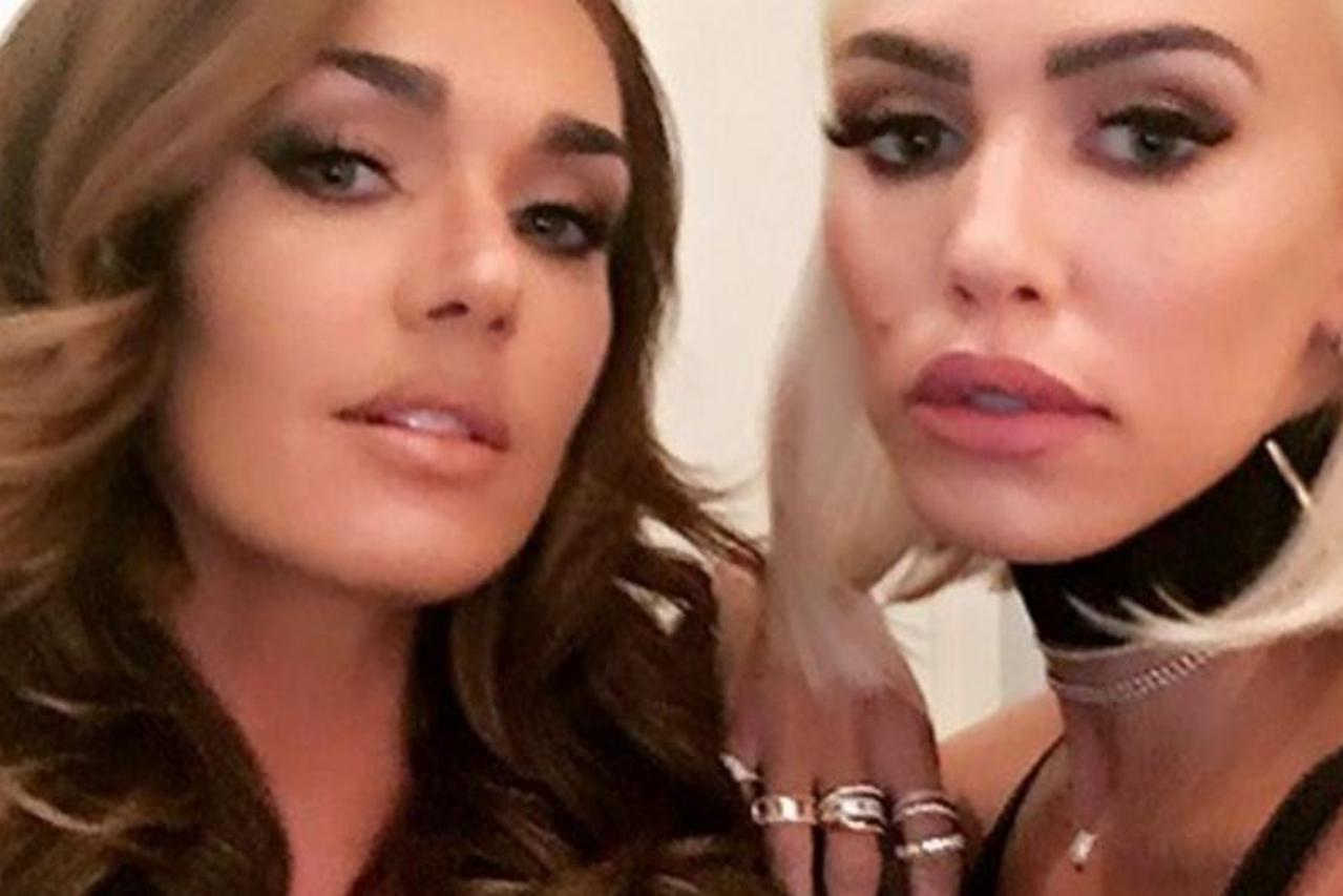 Petra Ecclestone nakon kozmetičkog zahvata
