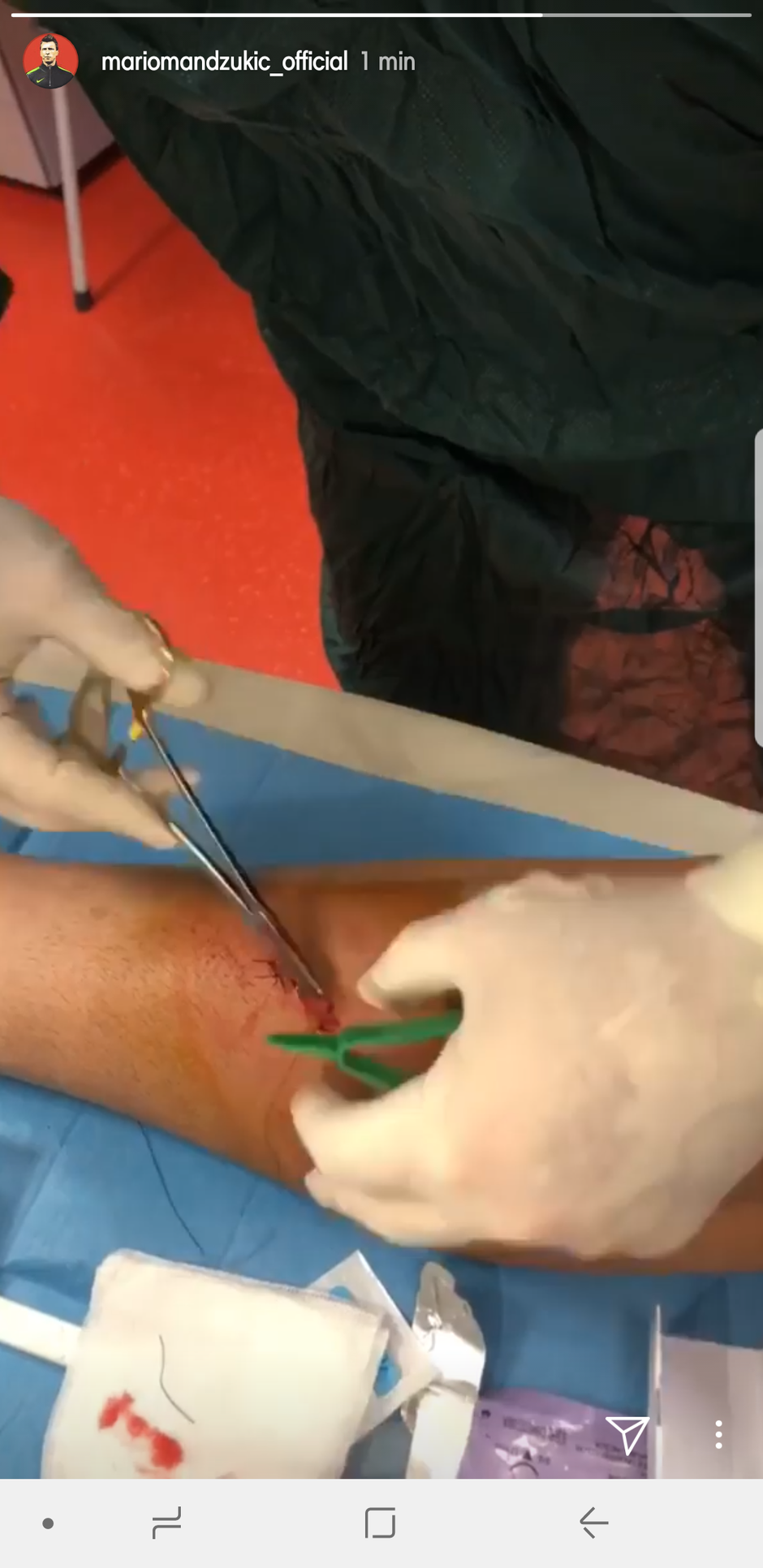 Mandžukić - ozljeda