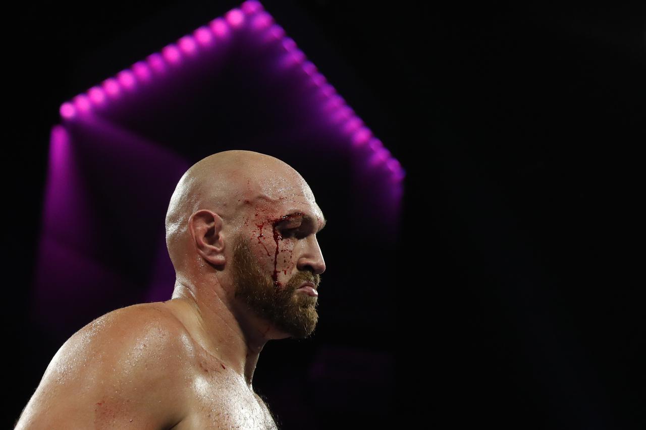 Tyson Fury