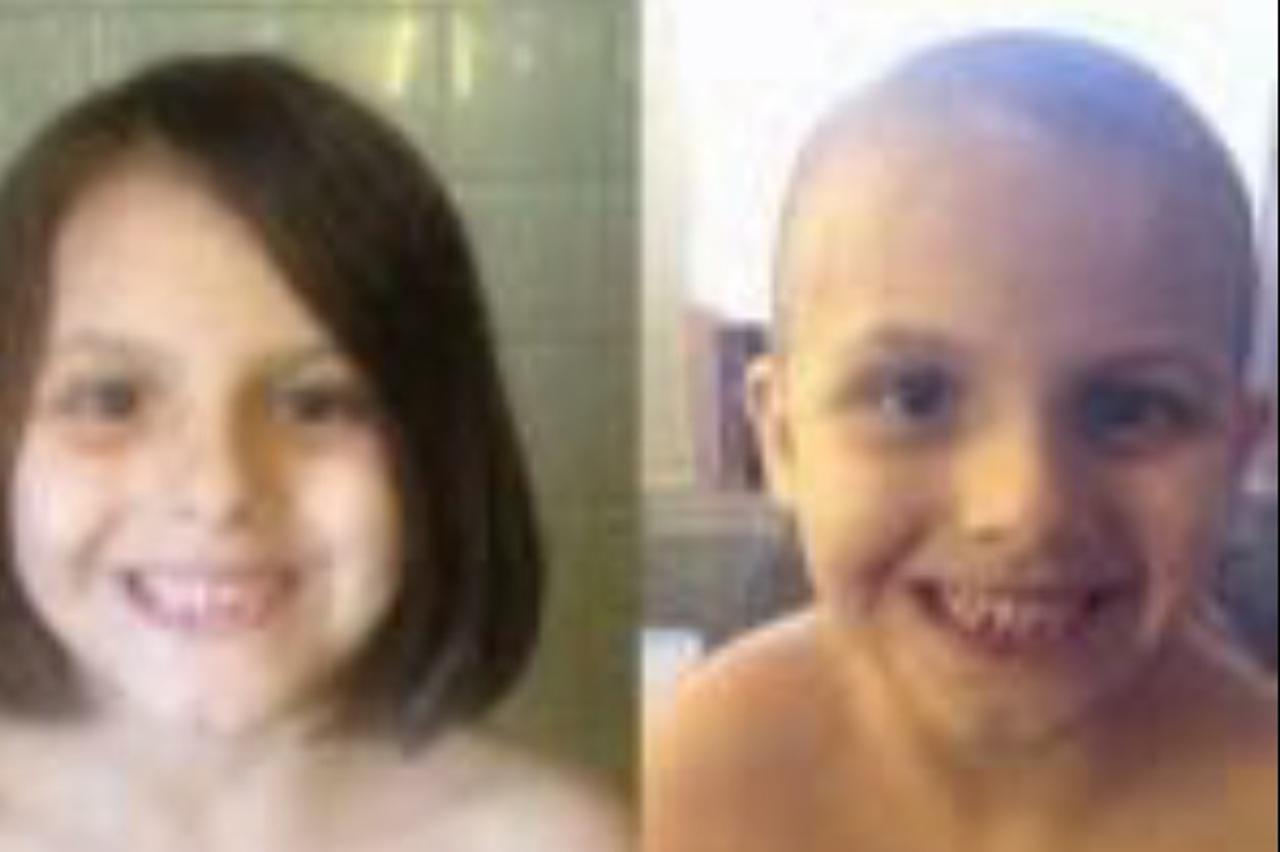 Obrijana djevojčica