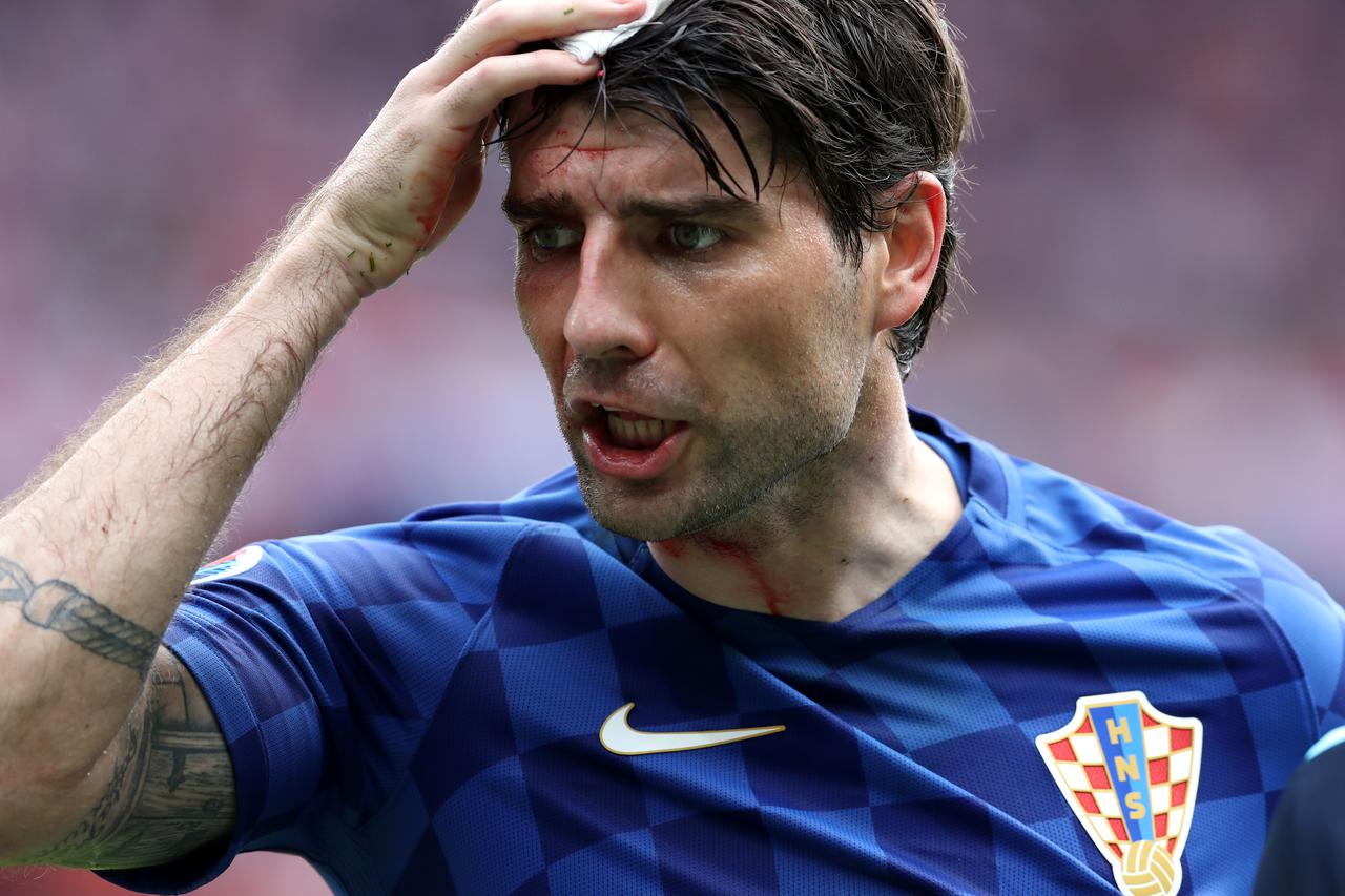 Turkey v Croatia - UEFA Euro 2016 - Group D - Parc des PrincesCroatia's Vedran Corluka holds a bandage to his head after picking up a head injury during the gameMartin Rickett Photo: Press Association/PIXSELL