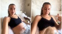 Addiction Left Her Without a Bladder: 'I Now Urinate Through My Navel, and Here's Why I Want My Story Heard'
