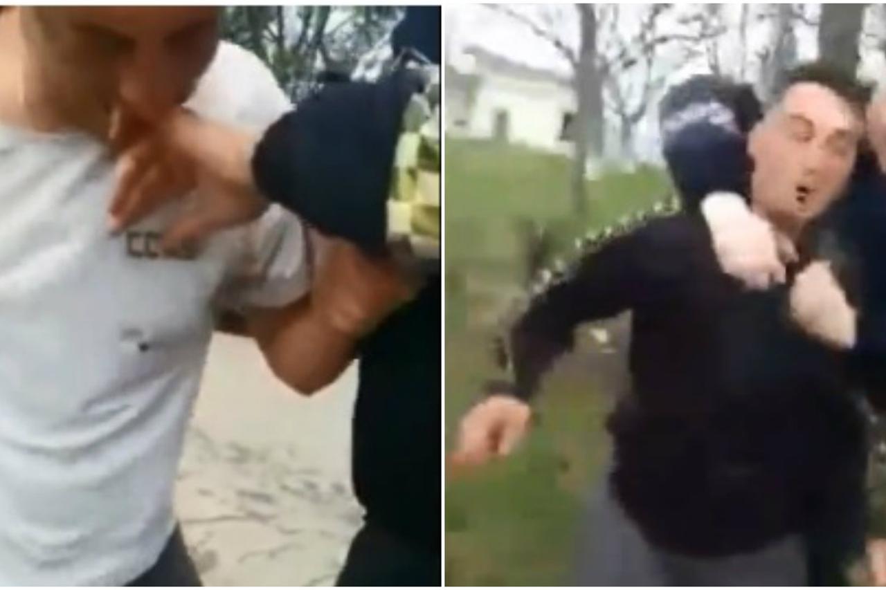 Ugrizao policajca za ruku