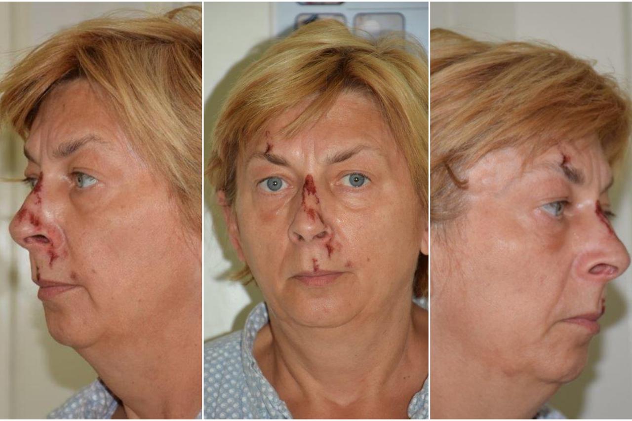 Žena nađena na Krku
