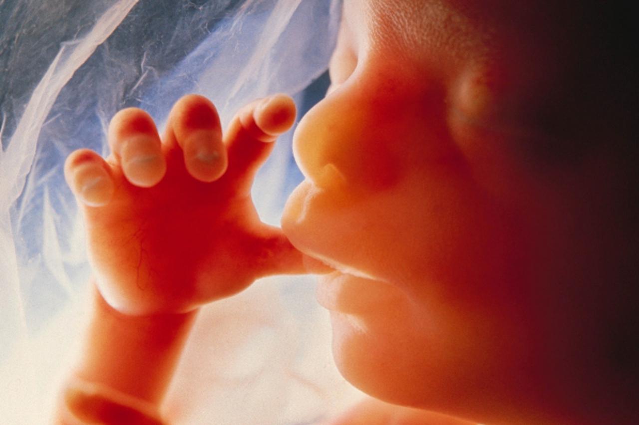 Fetus