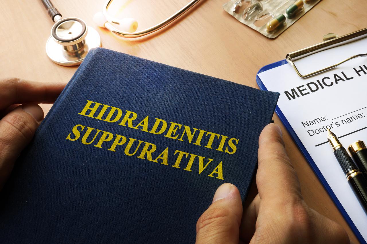 Hidradenitis suppurativa/acne inversa