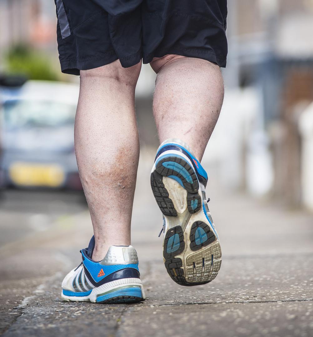 Odlučio je podijeliti s javnošću svoj problem u nadi da će mu netko pomoći da pronađe pristojne cipele i napokon pronađe posao. 