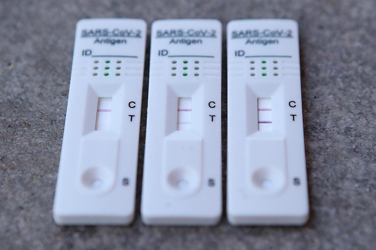 Brzi antigenski test