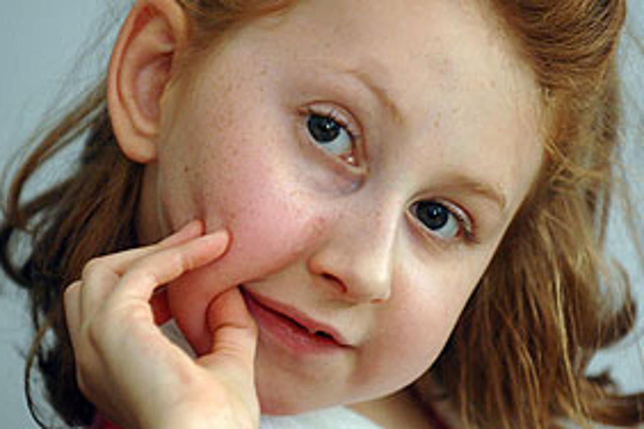 Antonija Sever prije operacije