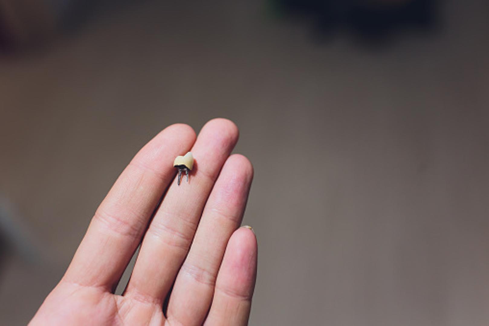 Još jedna česta noćna mora je i ispadanje zubi. Ovaj san povezuje se s problemima u komunikaciji. Možda ste nedavno rekli neku tajnu nekome kome niste trebali, a sada se osjećate krivi. 