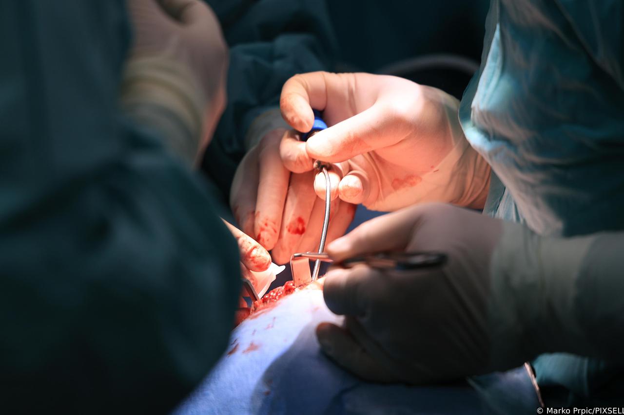 Zagreb: Tim liječnika iz KB Dubrava ugrađuje čovjeku čeljusni zglob