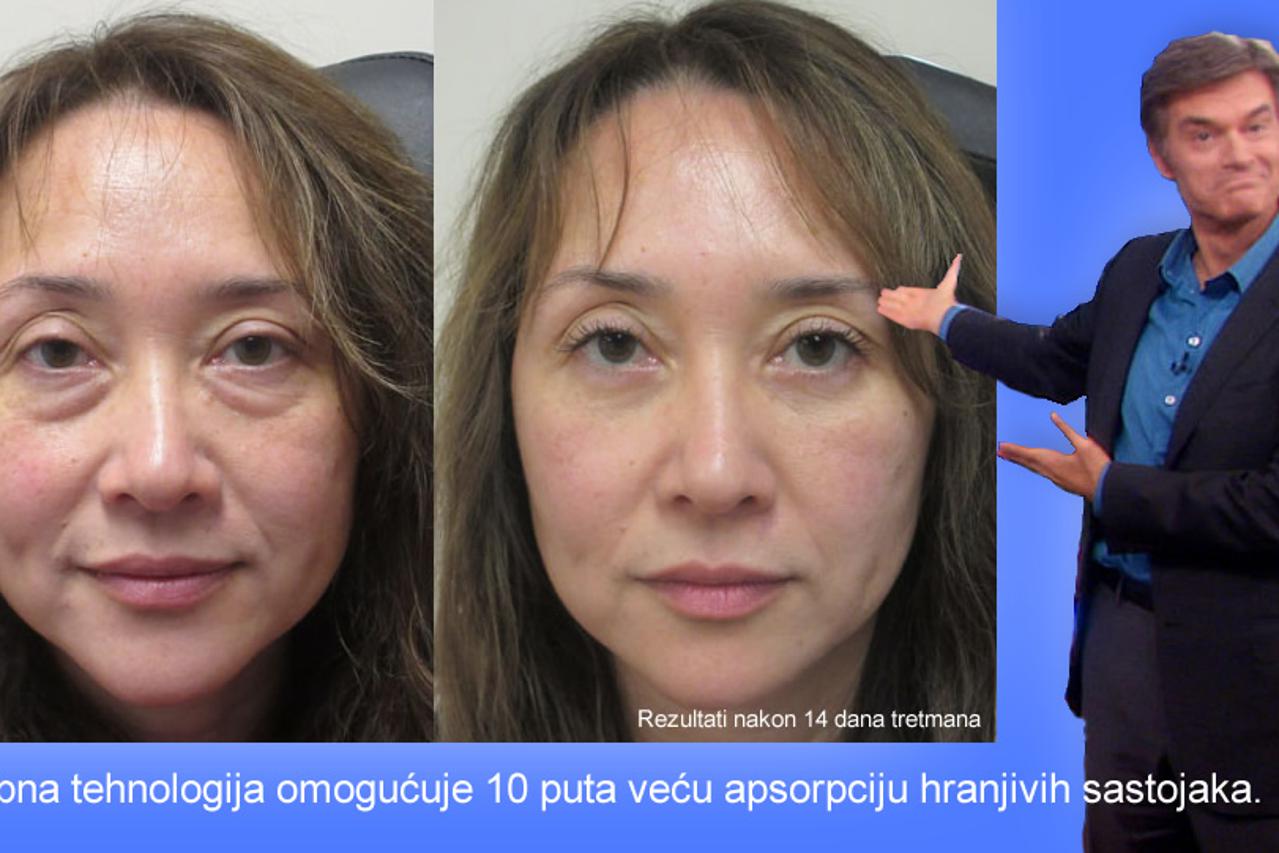 Lijepe oči - riješite se podočnjaka u samo pola sata!