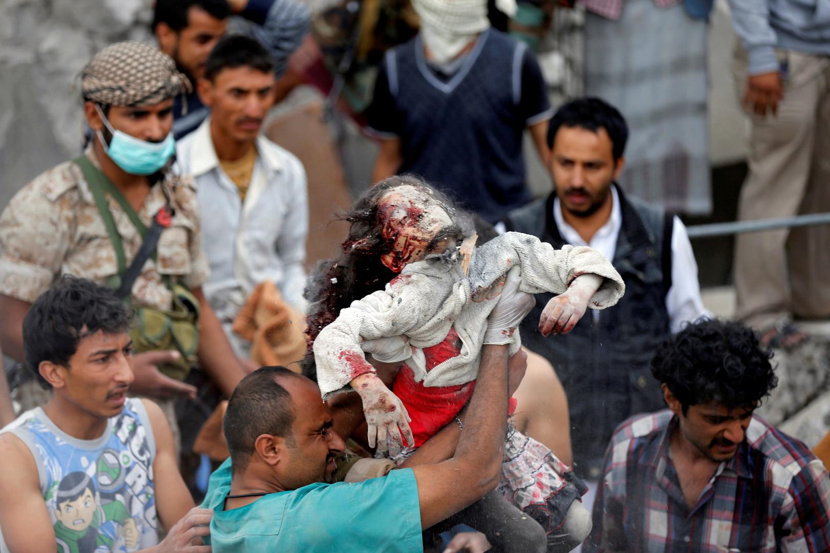 Bolničar drži tijelo 7-godišnje Ayah Muhammad Mansour, koja je pronađena pod ruševinama kuće uništene u zračnom udaru snaga predvođenih Saudijskom Arabijom u Jemenu. 
