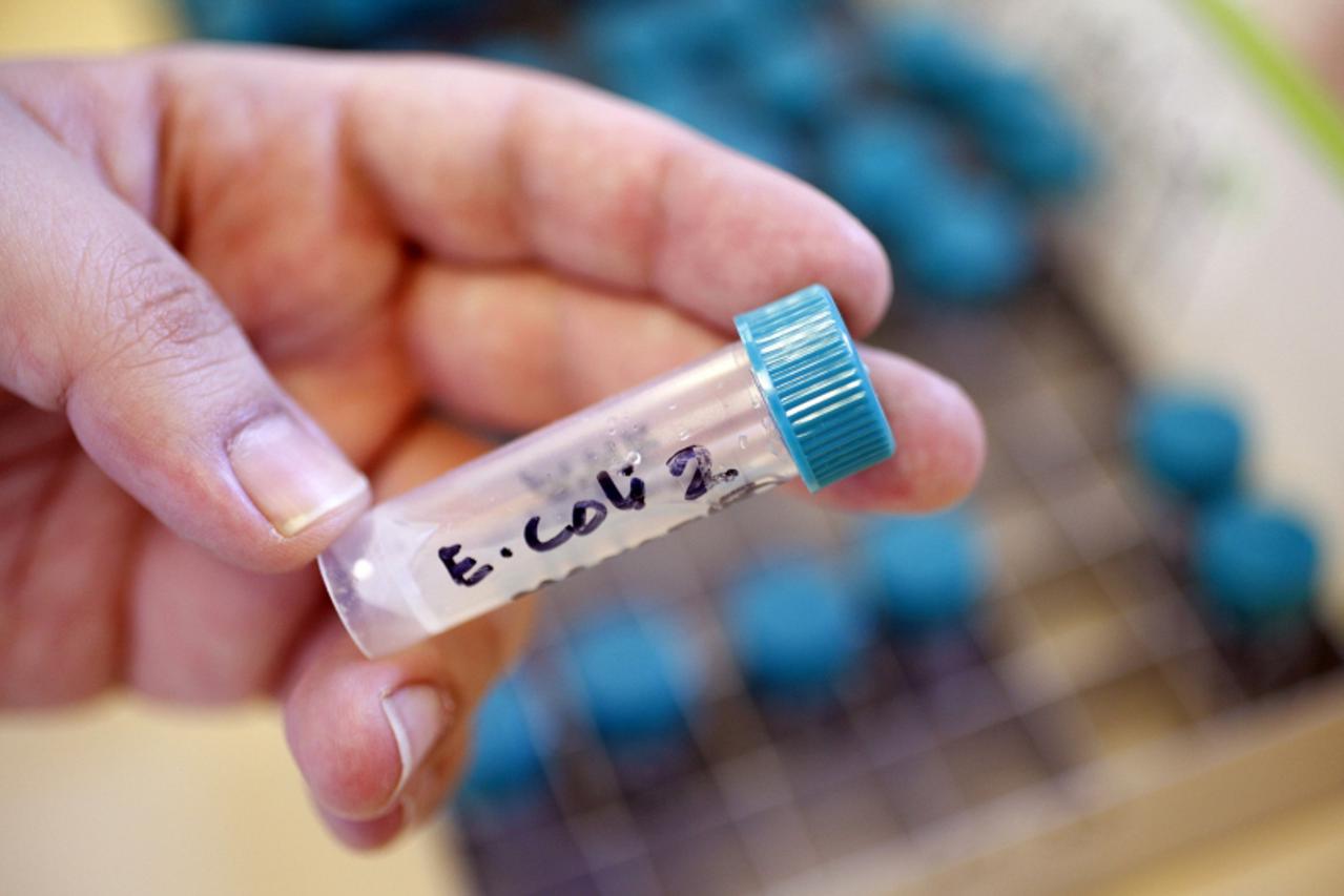 'A sample bottle containing E. coli bacteria is seen at the Health Protection Agency in north London March 9, 2011. For decades scientists have managed to develop new medicines to stay at least one st