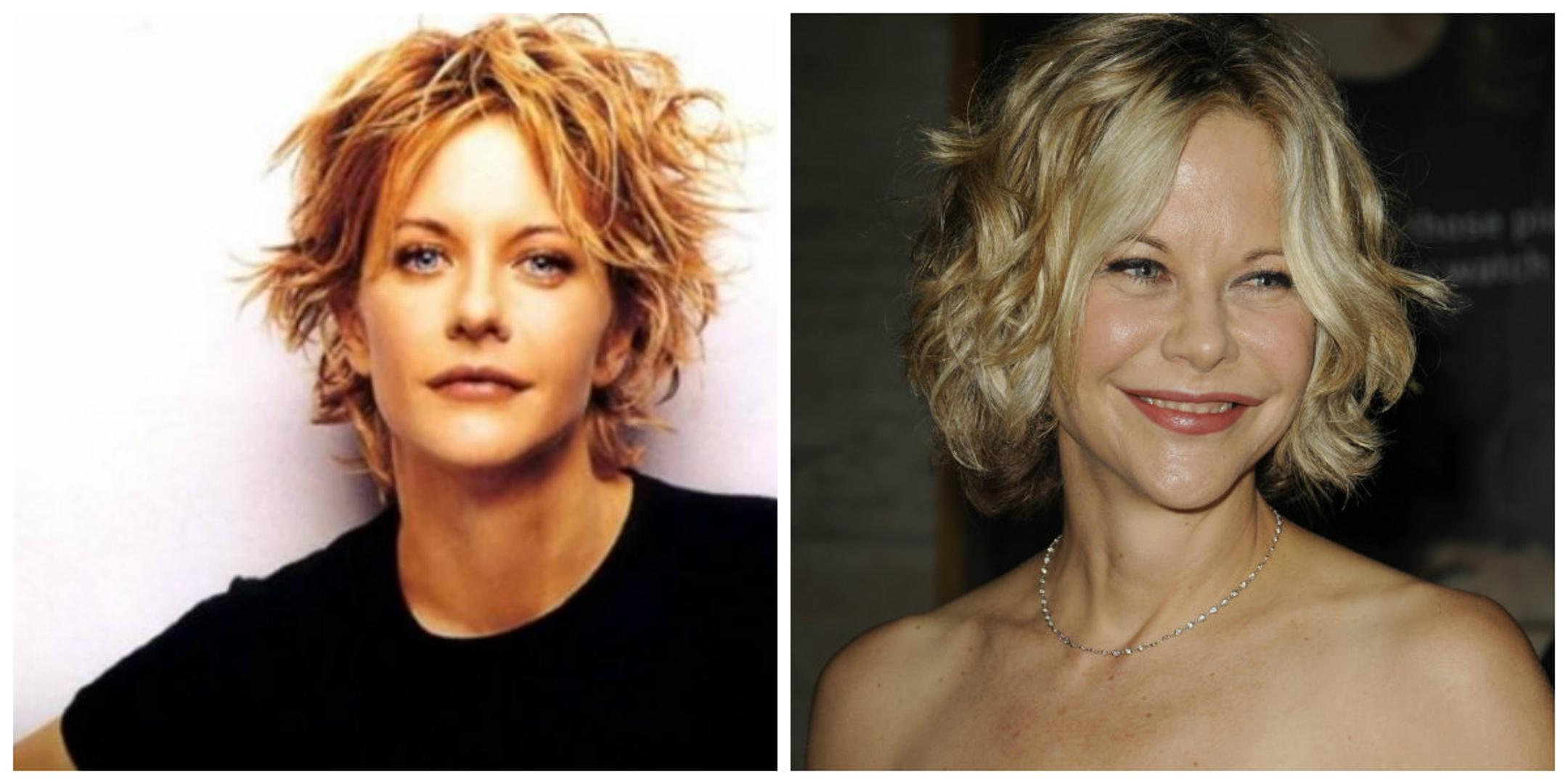 Kraljica romantičnih komedija Meg Ryan zamrznula je svoje lice botoksom i operacijama. U želji da sačuva status holyywoodske slatkice Meg je pretjerala i postigla sasvim suprotan efekt. 