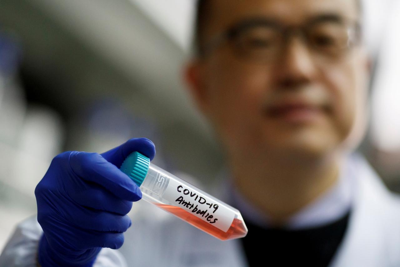FILE PHOTO: Scientist Linqi Zhang shows a tube with a solution containing COVID-19 antibodies in his lab he works on research into novel coronavirus disease (COVID-19) antibodies for possible use in a drug at Tsinghua University in Beijing