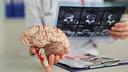 Neurologinja otkriva: Ovih 7 svakodnevnih navika mogu smanjiti rizik od moždanog udara
