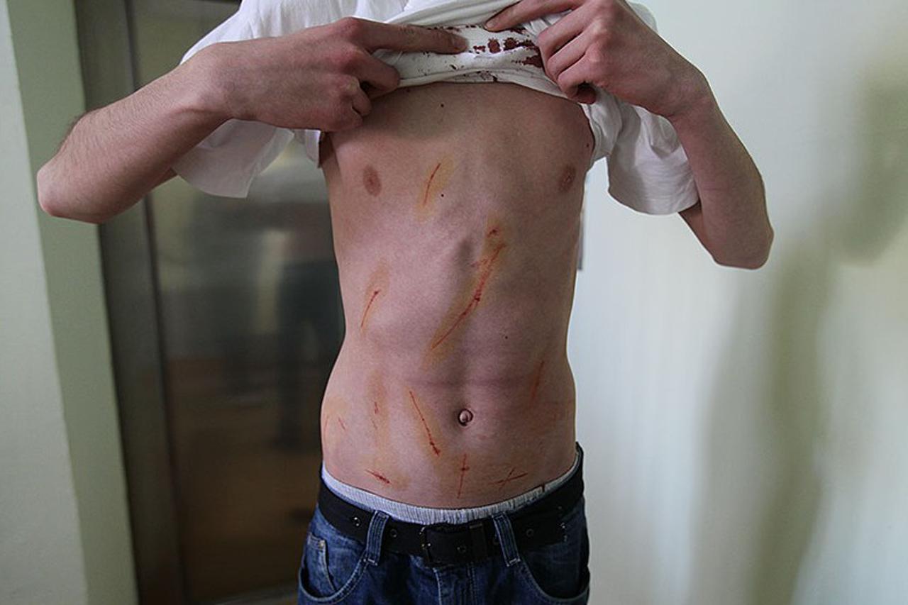 virovitica napad (1)