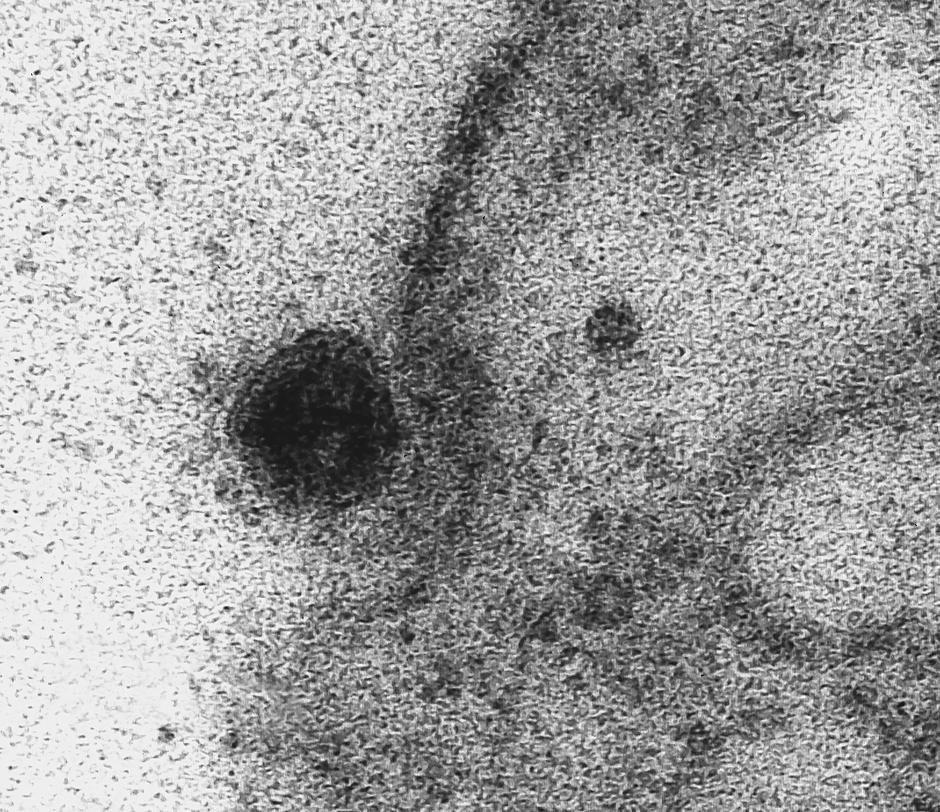 Dodatno uvećana fotografija virusa koji ulazi u citoplazmu kroz membranu