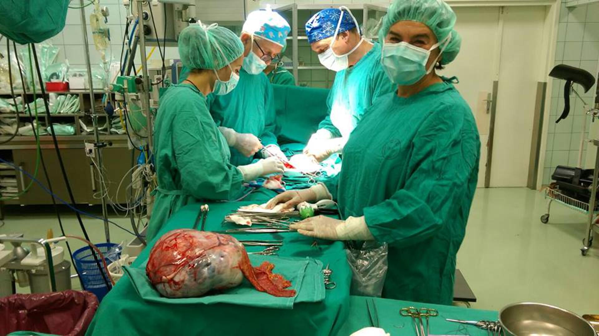 Golemi tumor pacijentici je potpuno odstranio liječnički tim koji je vodio prof. dr. sc. Damir Eljuga. Nasreću, nije metastazirao