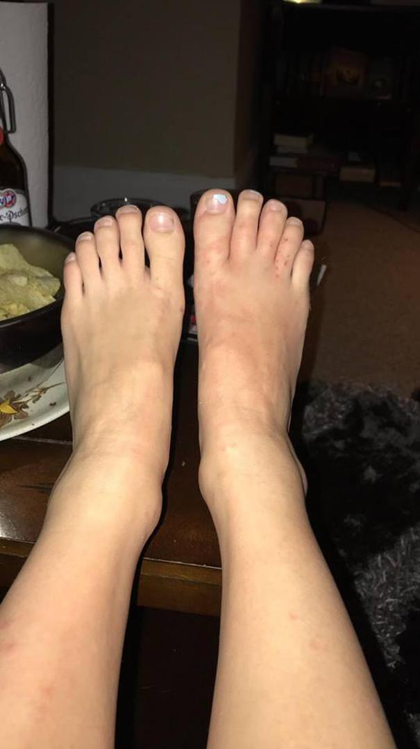 Nakon toga su oboje potražili liječničku pomoć, a pomoći im je znao tek treći liječnik kojeg su posjetili, piše Daily Mail. 

