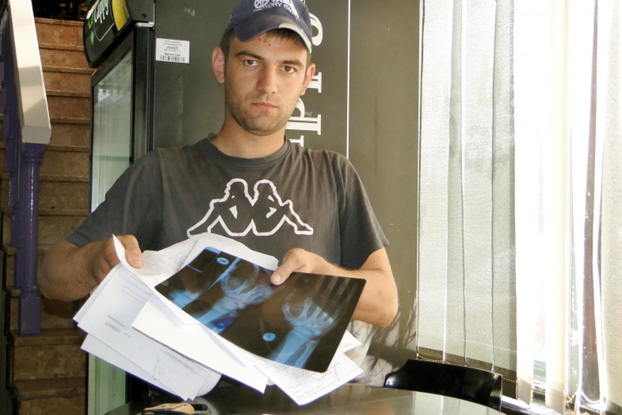 'odravina - 110610-slatina  - hrvoje vida s lijecniskom dokumentacijom koja pokazuje da ima slomljenu desnu saku, a koju su mu, po njegovoj izjavi, slomili policajci prilikom uhicenja  snimio Dragutin