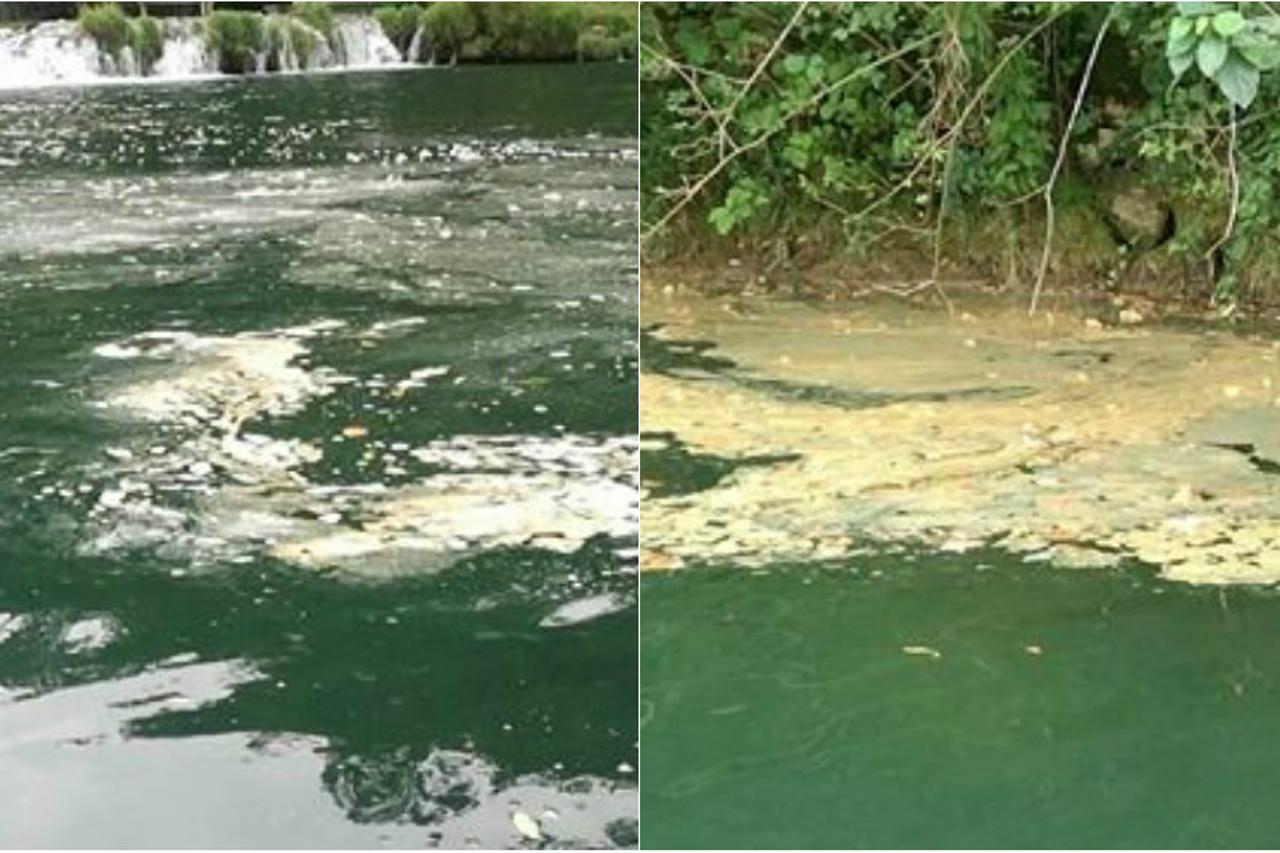 Masna mrlja na Mrežnici