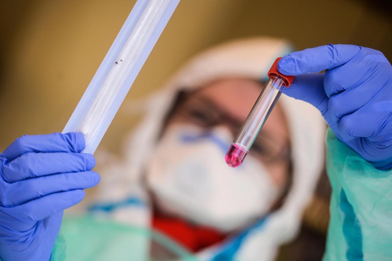 Testiranje na koronavirus