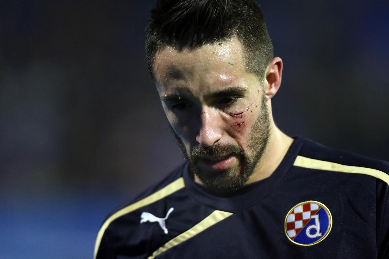 Dinamo je 2014. pobijedio Celtic 4-3, tri gola zabio je Marko Pjaca