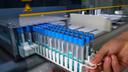 Salmonella Outbreak Linked to Belgian Eggs Infects Over 300, Triggers European Warnings