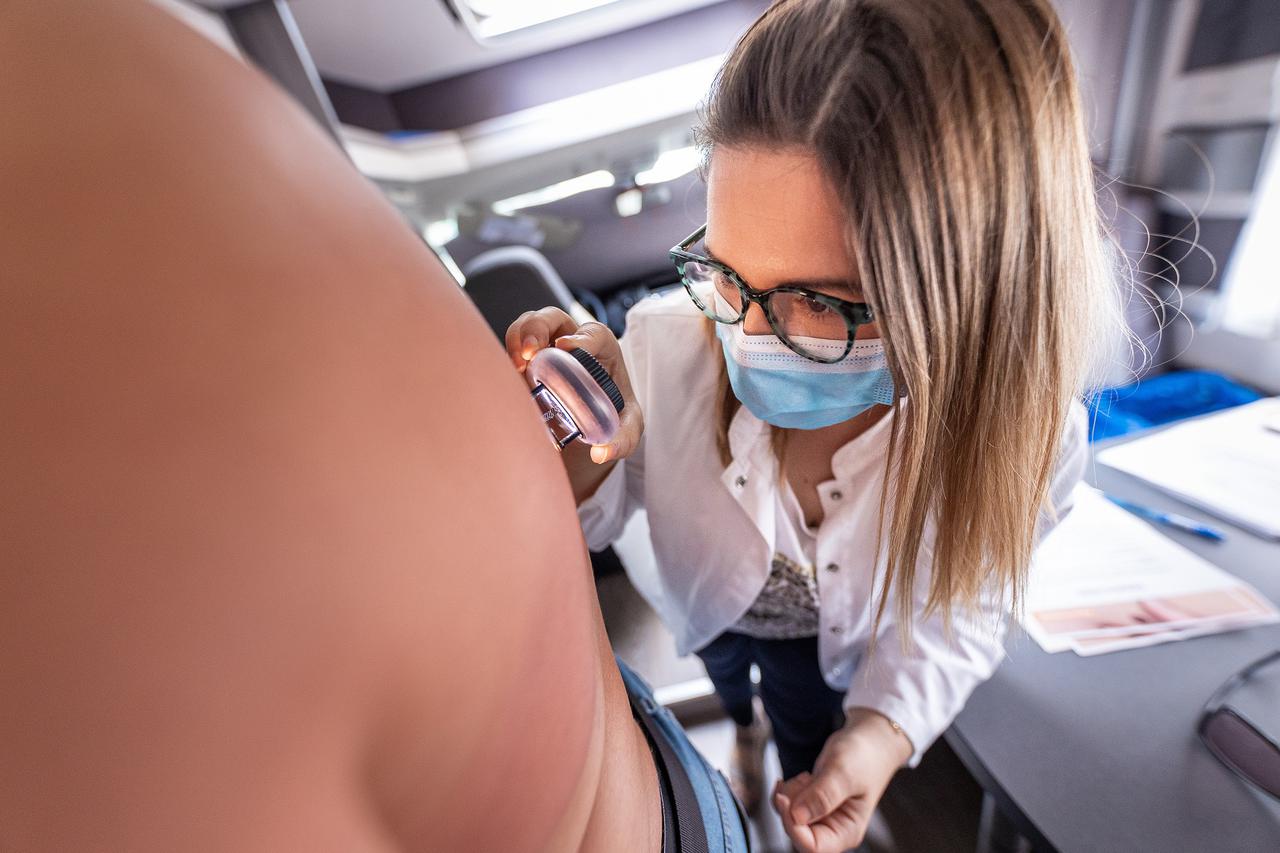 Besplatni pregledi madeža