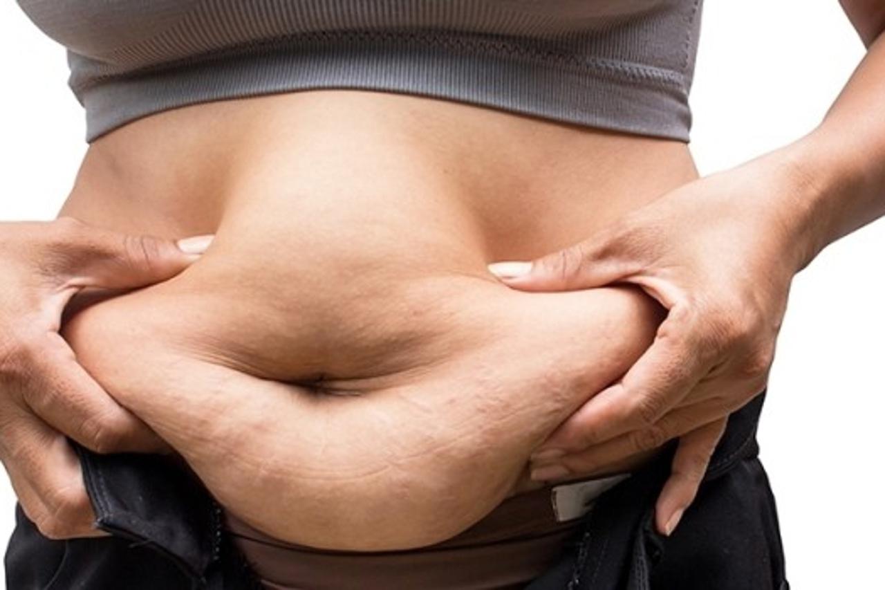 BellyStop