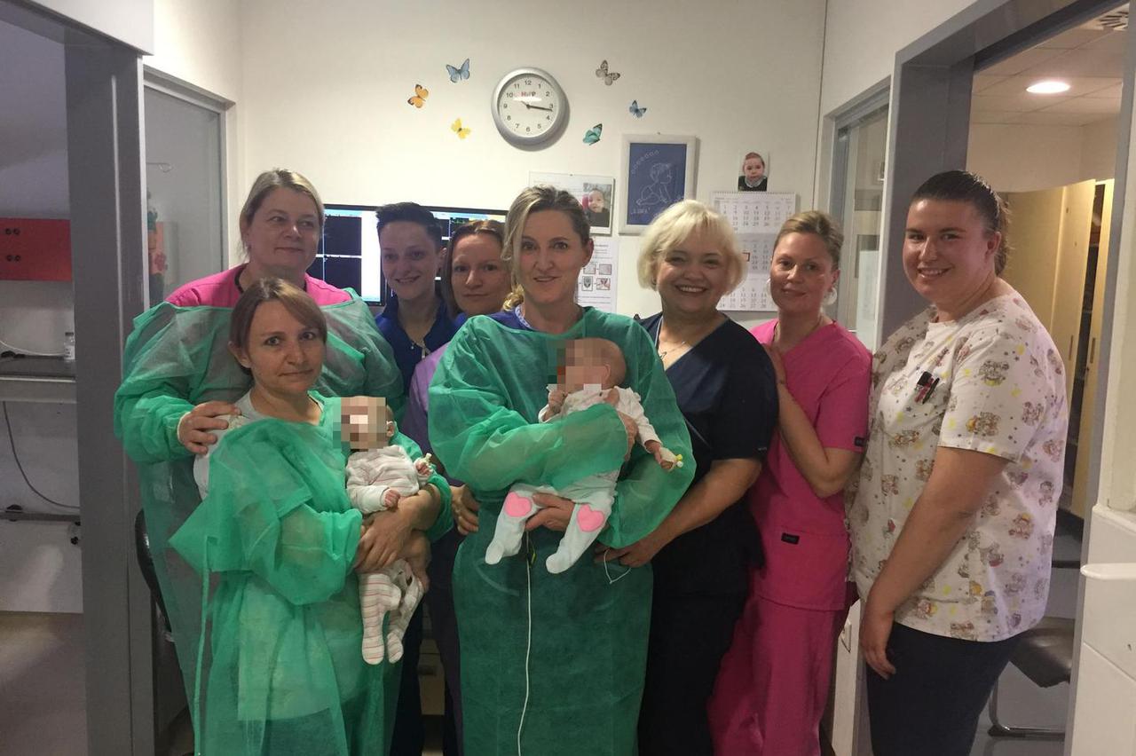 Sijamske blizanke Kristina i Valentina