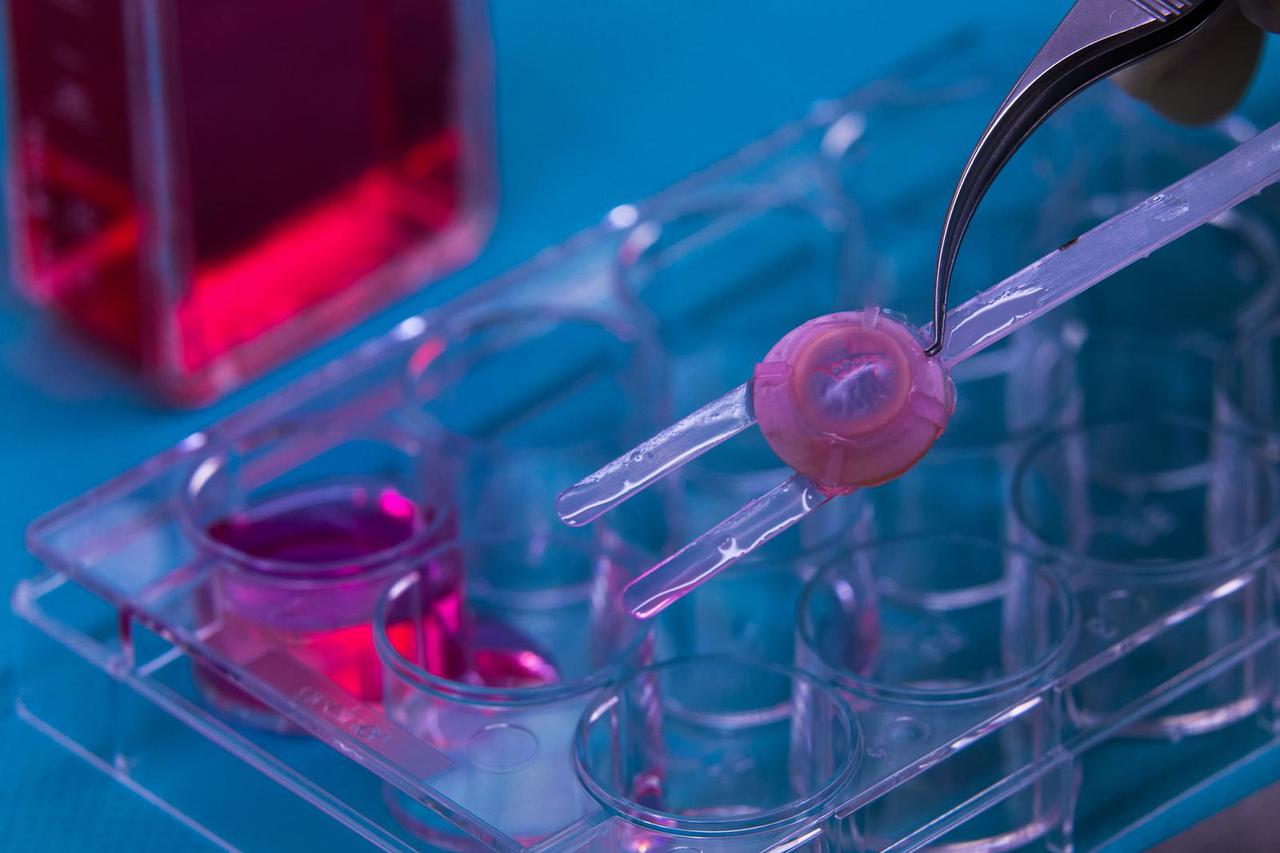 Rostock: Priprema rožnice za transplataciju 