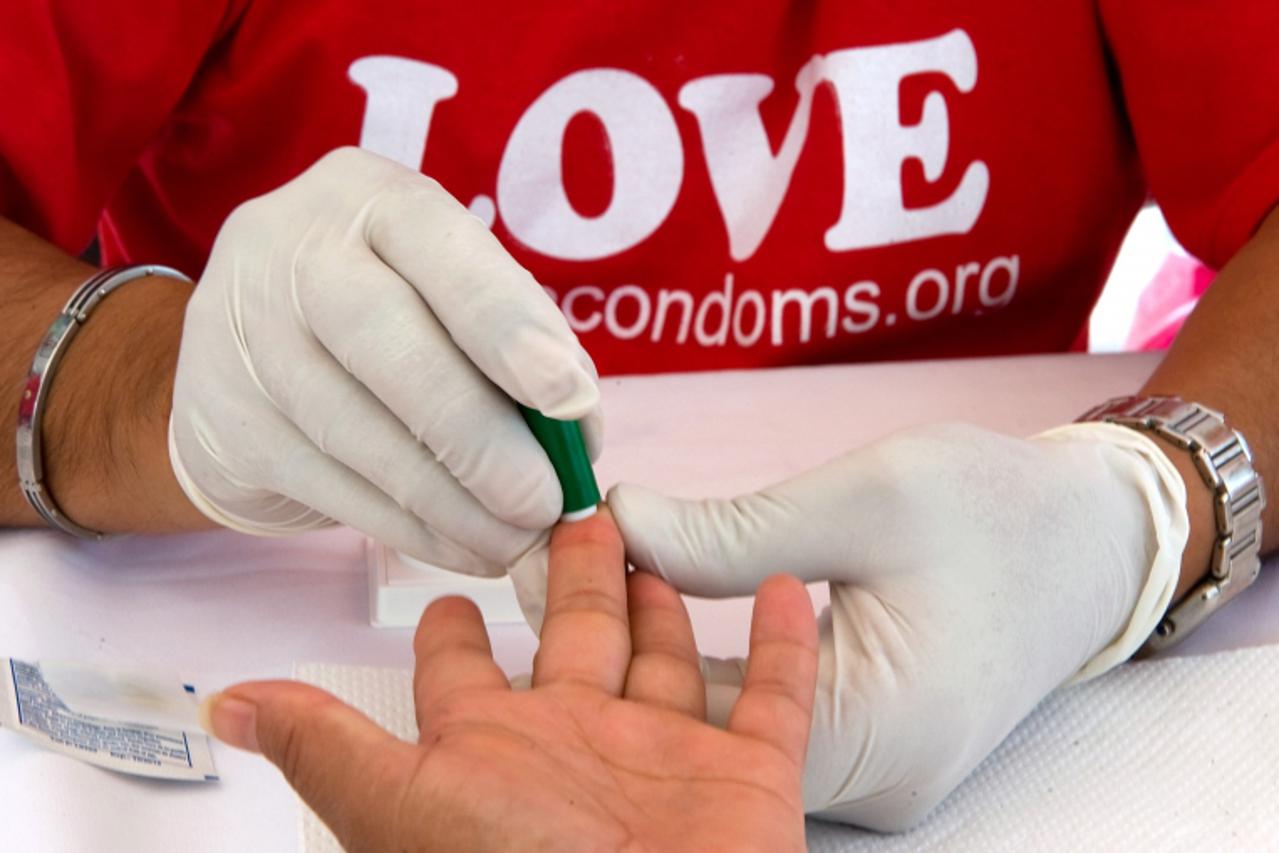 hiv