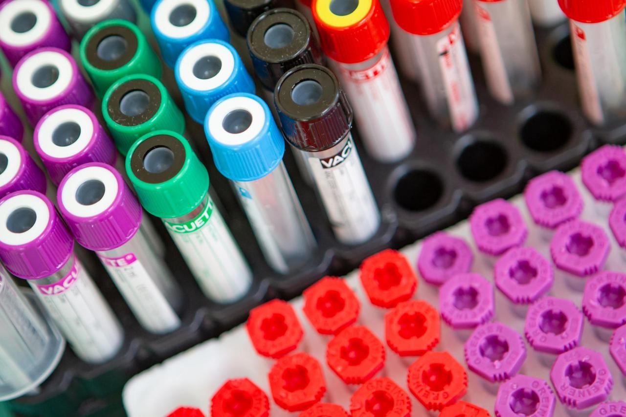 Medicinski pribor u bolnici