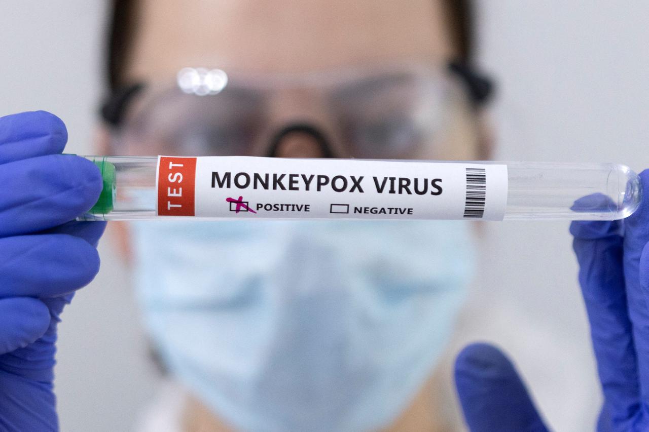 Illustration shows test tubes labelled "Monkeypox virus positive\
