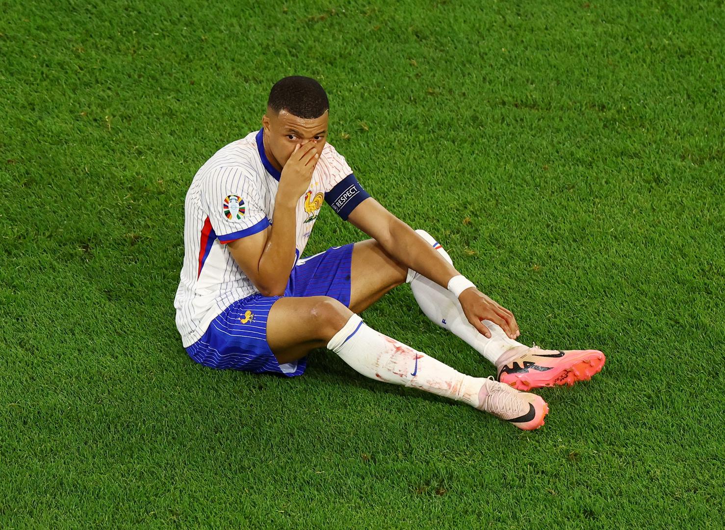 Naime, najvažniji igrač francuske reprezentacije morao je izići iz igre zbog ozljede nosa, koja je uslijedila nakon što se glavom zabio u rame Kevina Dansa. 