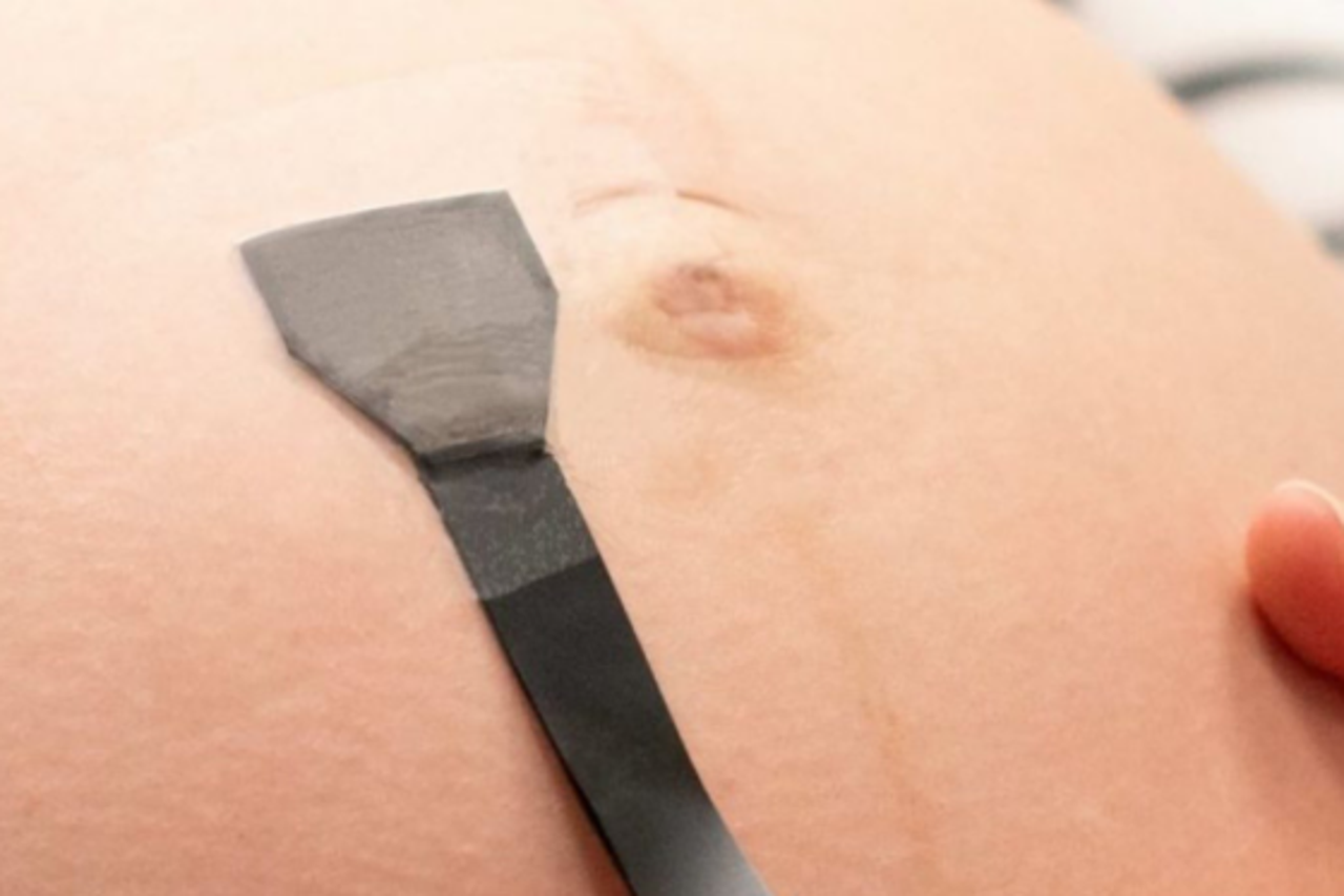 Feed/Ordinacija-Homepage/2026-23/Ultrasound-1500-Px-560X560.Png