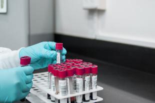 Znanstvenici potvrdili da ljudi s ovom krvnom grupom žive najduže: “Rijetko obole od najtežih bolesti”