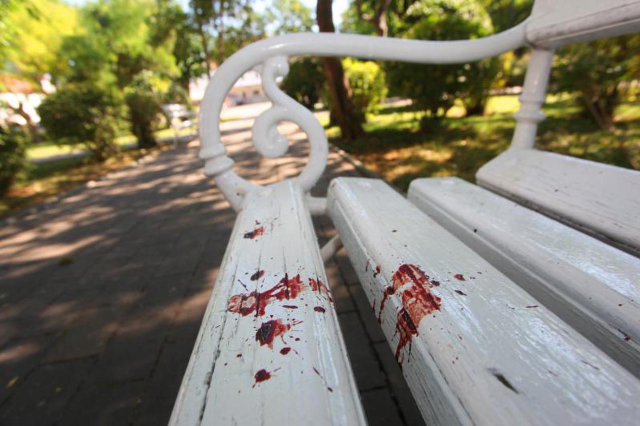 ranjena djevojka, krv, ranjen, propucan (1)